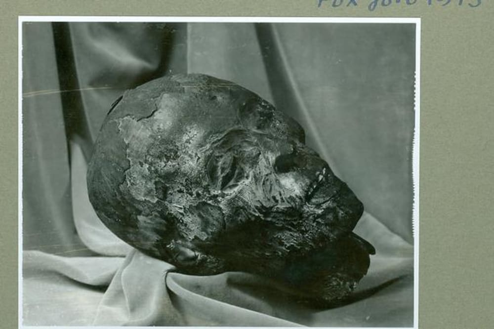 Hovedet af en mumie, som egyptologen Valdemar Schmidt pakkede ud foran publikum i 1895.Foto: Medicinsk Museion