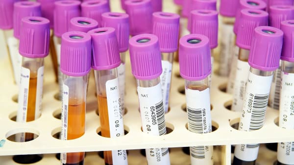 DTU og Aarhus Universitet advarer mod regeringens planer for sundhedsdata: Ikke behov for stort statsligt it-system