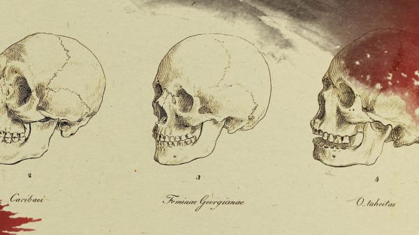 I en kælder under Panum ligger flere hundrede kranier fra udlandet. Hvorfor ligger de der?