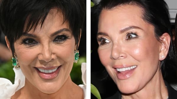 Kris Jenner er næsten 70, men ser langt yngre ud: Bærer 'sit nye ansigt som var det en designerkjole'