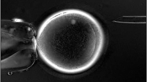 Gennembrud: Forskning åbner for, at homoseksuelle par kan få biologiske børn sammen