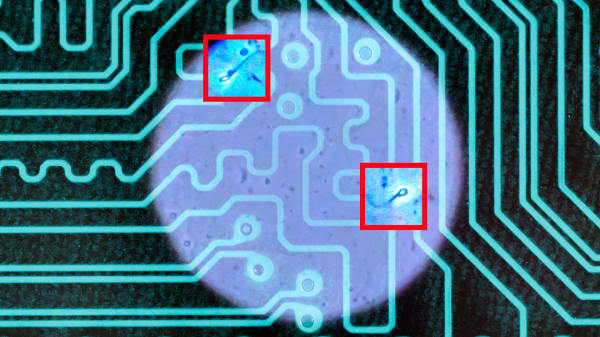 Amerikansk par blev gravide med AI: 'Spændende resultat', lyder det herhjemme