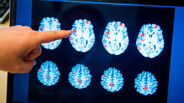 Forskere har gjort en overraskende opdagelse: Måske er din hjerne først voksen som 32-årig