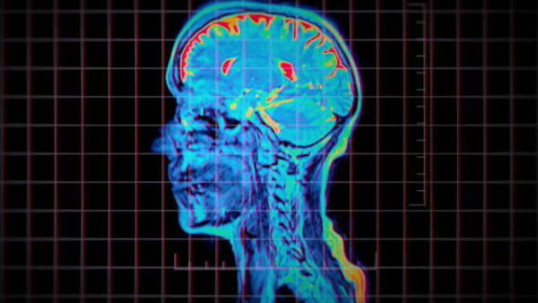 Ny Netflix-serie undersøger nærdødsoplevelser: Derfor kan der ske sære ting i hjernen, når du dør