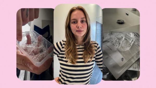 Tandlægekonkurs koster Camilla tusindvis af kroner: 'Det er så nederen'